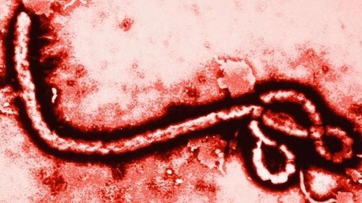 Sospetto Ebola, isolato a Cagliari un paziente rientrato dalla Repubblica Democratica del Congo
