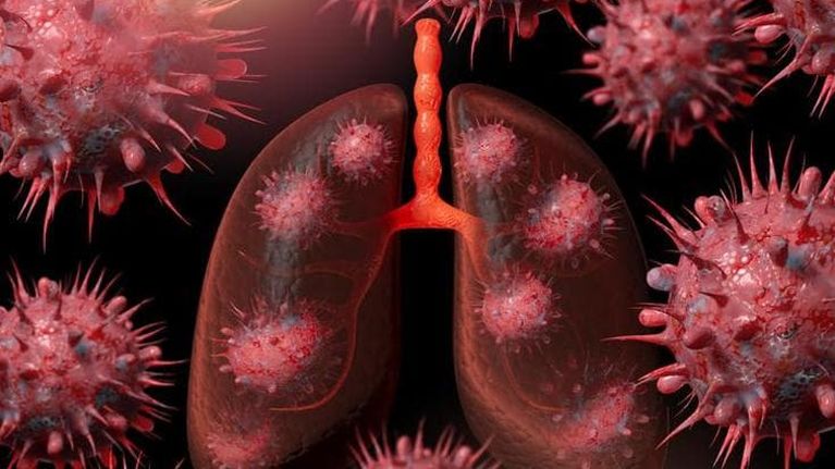 Tumore al polmone, vaccino sperimentale aumenta la sopravvivenza fino al 47%