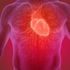 Infarto acuto, ecco l’analisi in 3D che aiuta a capire per quali arterie serve lo stent