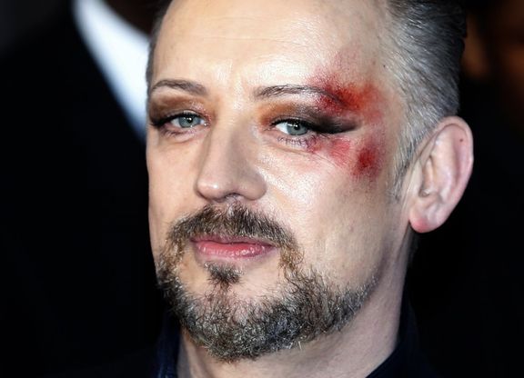 Londra, tappeto rosso con livido in faccia per Boy George