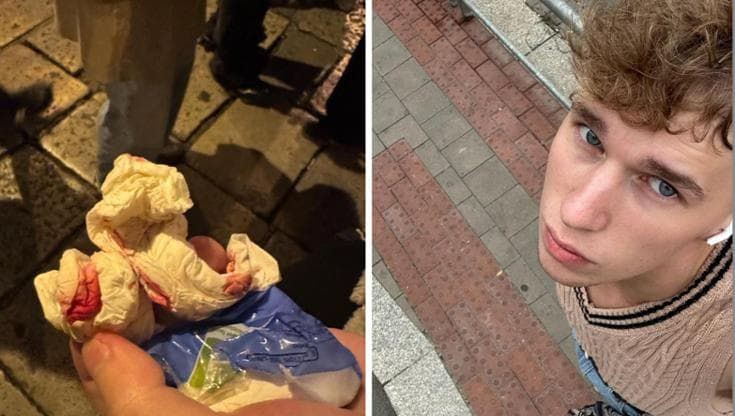 Picchiato davanti agli agenti: turista ceco aggredito di notte a piazza Sant’Anna