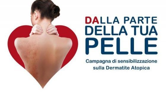 "Dalla parte della tua pelle", visite gratuite per combattere la dermatite atopica