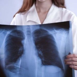 Tumori, crescono i casi tra le donne ma si vive più a lungo 