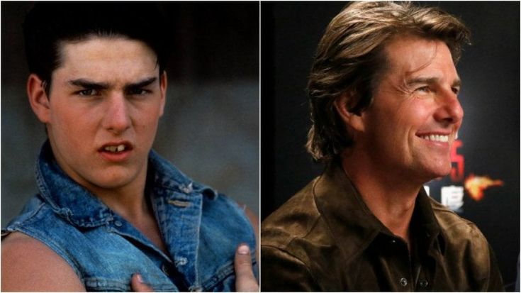 C'era una volta un brutto anatroccolo: la rivincita delle star di Hollywood