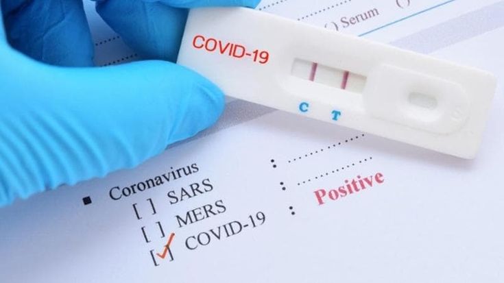 Il ritorno del Covid, i casi crescono ma si fanno pochi tamponi. “Diffuse molte malattie respiratorie”
