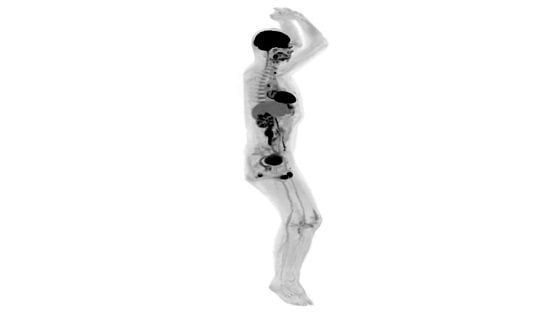 Explorer, il primo scanner total body al mondo