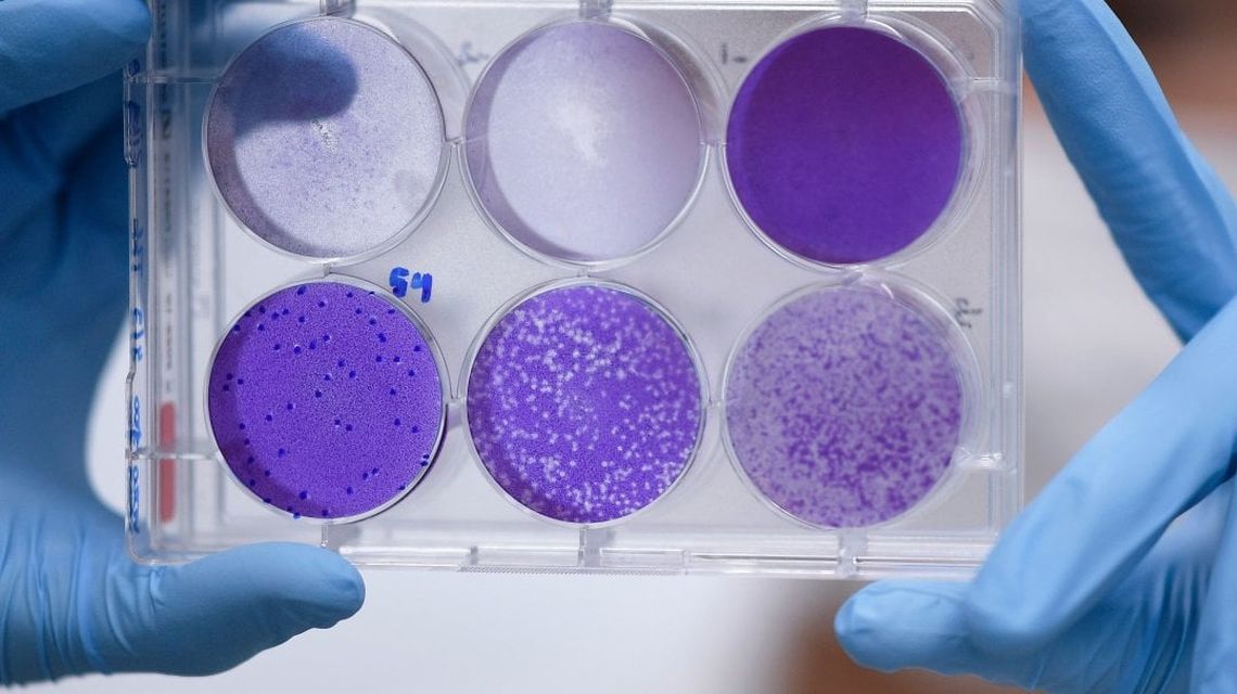 Vaccino Coronavirus A Che Punto E La Ricerca La Corsa All Oro Rep