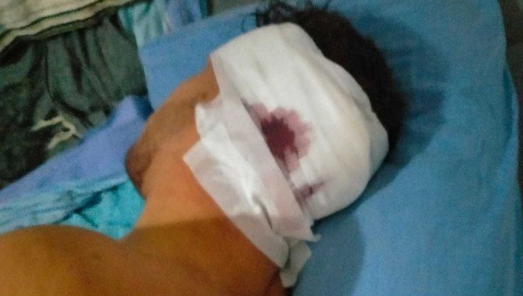 L’aggressione alla sagra di Ariccia, la mamma del ferito: “Voleva sgozzare mio figlio per una pipì” 