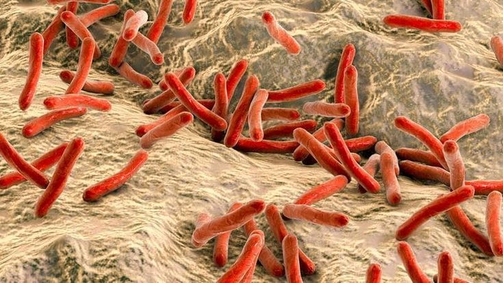 Croazia e Romania in allarme per sei casi di lebbra. La malattia in numeri minimi è anche in Italia