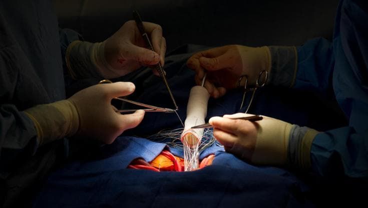 Interventi all’aorta, grazie a due studi sarà più facile ridurre il rischio dell’intervento