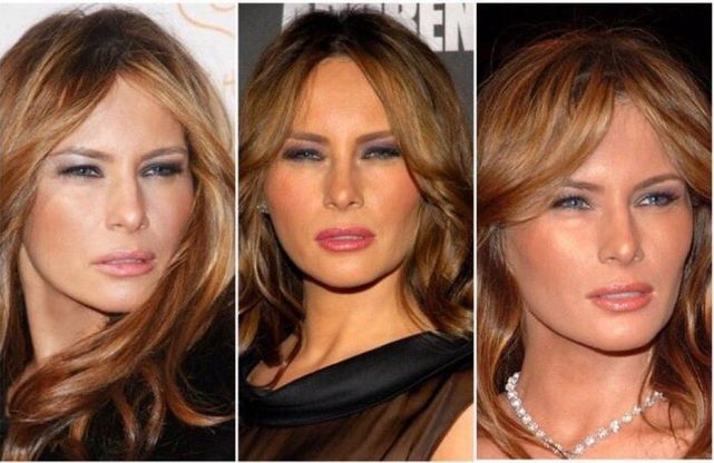 Lo sguardo ambiguo di Melania Trump: ironia sulla first lady "accecata" 