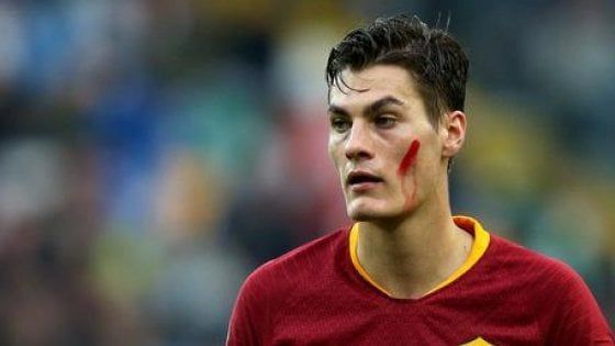 Roma, Schick: "Sto bene, il Derby speciale e spero di esserci"