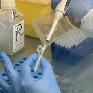 Fondazione Telethon finanzia sette progetti di ricerca sulle malattie genetiche rare