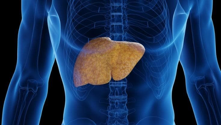 Tumore avanzato del fegato, un paziente su sei vivo a sei anni con immunoterapia