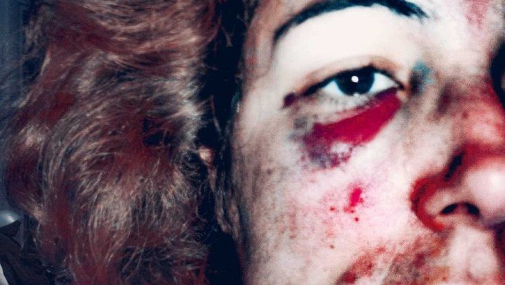 “Cara Palombelli, ho pubblicato le foto del mio volto insanguinato per dar voce alle vittime di femminicidio che ora non possono più parlare"