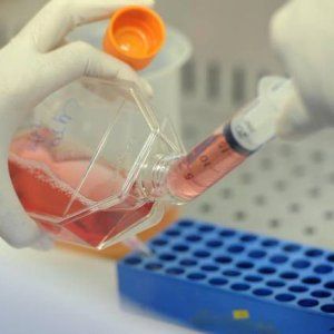 Tumori: "Un farmaco rallenta dell'88% la crescita del cancro alla prostata"
