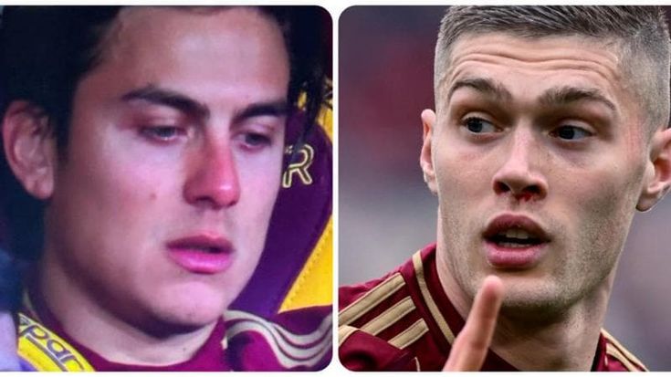 La Roma batte 1-0 il Cagliari ma si spaventa per Dybala, che esce piangendo