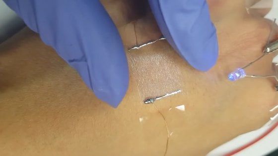 Altro che auricolari, il cerotto smart trasmetterà suoni e voce alla pelle
