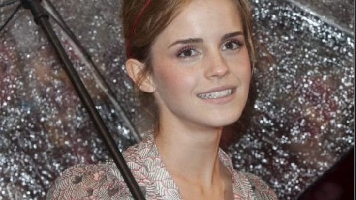 Emma Watson, la magia non cancella la multa: sei mesi senza patente per eccesso di velocità