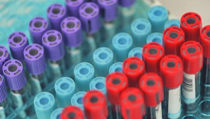 Parma, al via screening prenatale per la diagnosi di anomalie cromosomiche