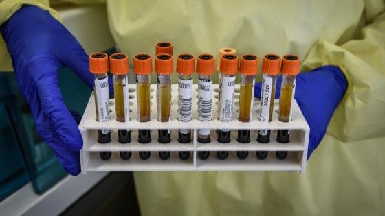 Coronavirus, la procura di Milano apre un'inchiesta sull'affidamento diretto dei test sierologici in Lombardia