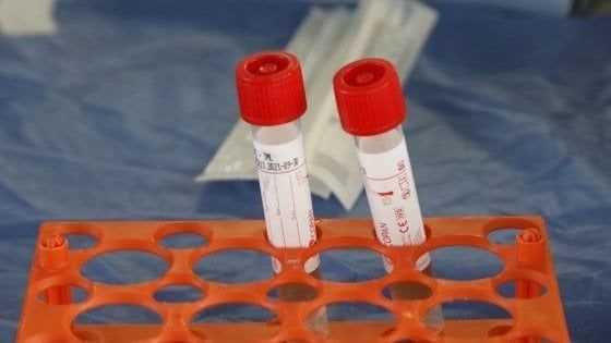 Napoli, 709 i positivi al Covid-19, 30 in più di ieri 