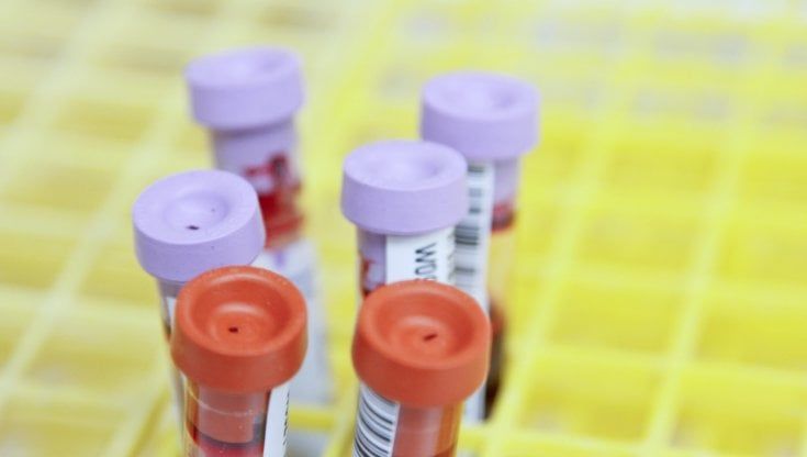 Ho il linfoma non Hodgkin: è consigliato nel mio caso il vaccino per herpes zoster?
