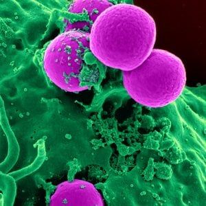 CAR-T per il mieloma multiplo, il 73% dei pazienti risponde a una nuova terapia cellulare