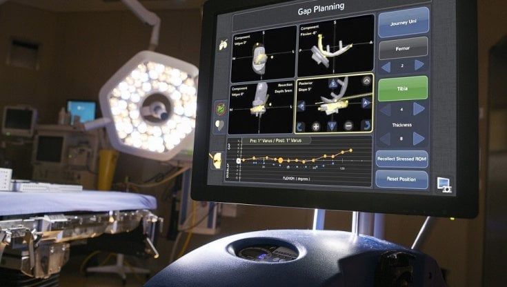 Protesi al ginocchio, un robot in sala operatoria a Conversano: è il primo al Sud per interventi mininvasivi