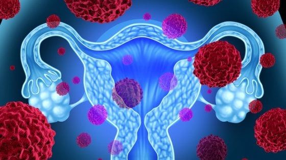 Papilloma virus, ecco perché sottoporsi ai test di screening fino a 65 anni