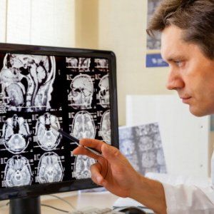 Ictus e danni neurologici: la scommessa della scienza sul fattore-tempo