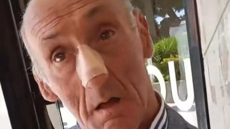 "Cerino” colpito al naso da un aggressore in moto: a Bari indignazione per la denuncia social