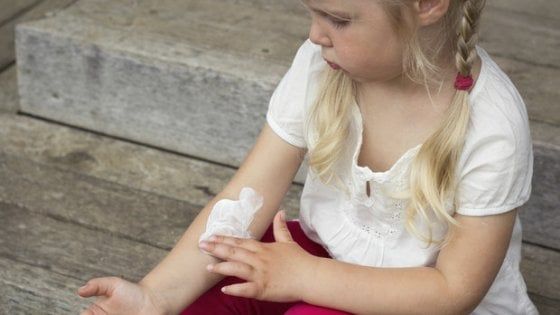 Dermatite, quali prodotti usare per eliminarla?