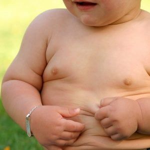 Obesity day, 10 volte più bambini obesi rispetto al 1975
