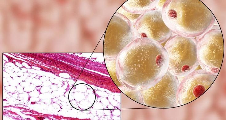 I pericoli della pancetta