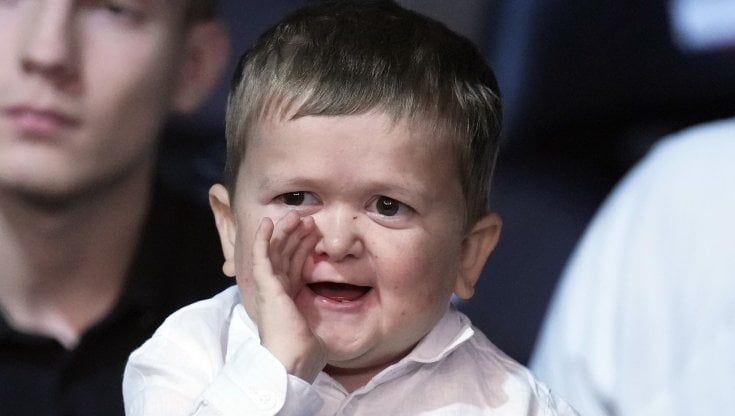 Hasbulla Magomedov, la star di TikTok con l'aspetto di un bambino, arrestato in Daghestan dopo una notte brava