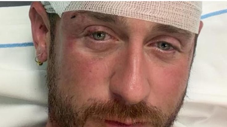 Angelo Ratti: “Io, picchiato perché gay. Va estirpato il cancro sociale dell’ignoranza e dell’odio”