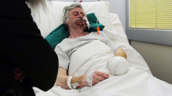 Brescia, arrestato l'ex sottufficiale dell'aeronautica ferito nell'esplosione di un pennarello