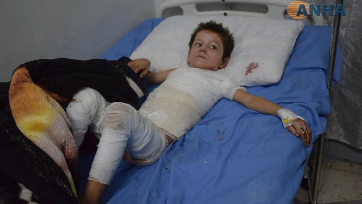 “Le armi chimiche contro i bambini”. Ma Ankara nega l’orrore in Siria