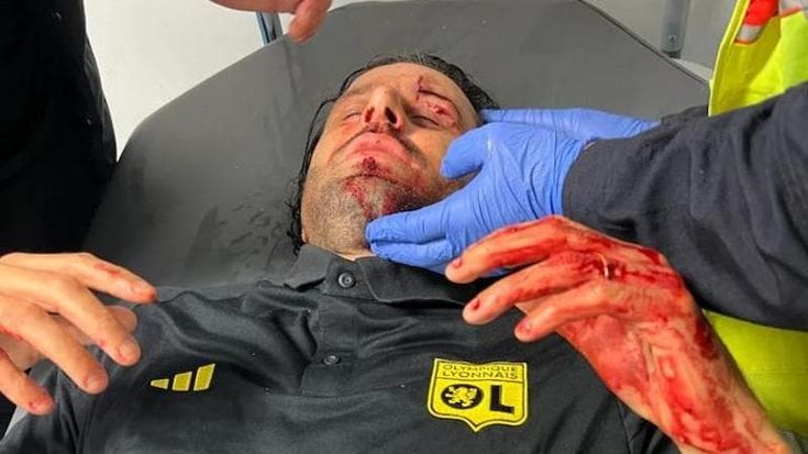 Marsiglia, assaltato pullman del Lione: Grosso ferito da una bottiglia lanciata dai tifosi di casa. Partita rinviata