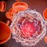 Leucemia mieloide acuta: l’italiana che sfida le recidive