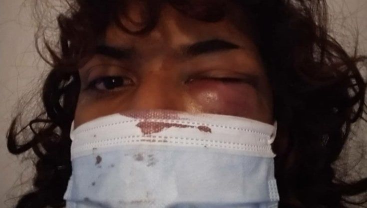Trans aggredita a Catania: "Adesso ho paura di andare al lavoro"