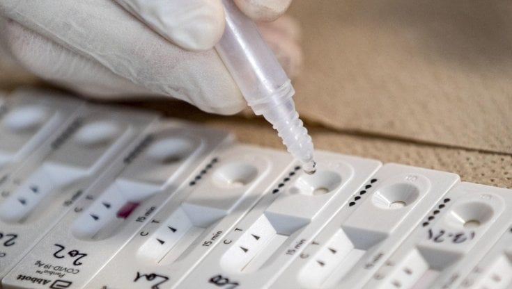Covid italia il bollettino del 27 ottobre 2022: 31.760 nuovi casi e 94 morti