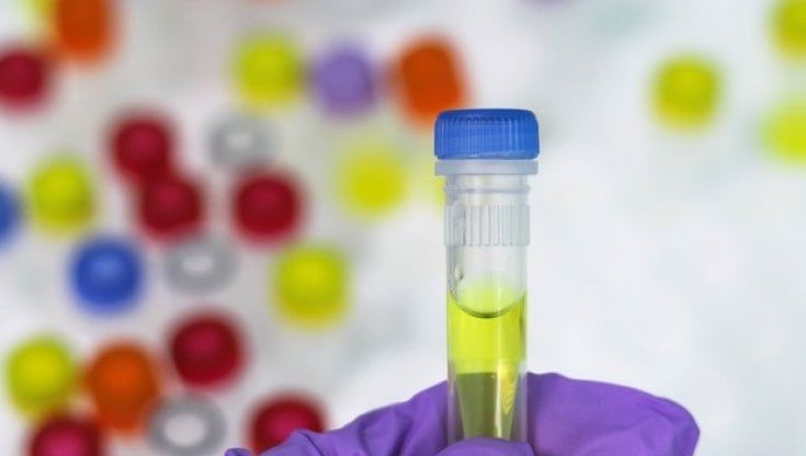 Disfunzioni del neurosviluppo, 8 milioni di euro per un nuovo farmaco