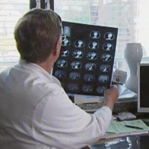 Tumore del colon-retto in fase avanzata: ogni anno più di 10mila diagnosi
