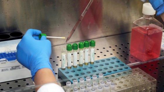 Coronavirus in Lombardia, i dati del 30 maggio: aumentano ancora i morti, sono 67 in un giorno