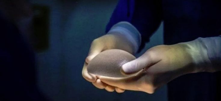 Protesi mammarie correlate al rischio di linfoma ritirate in tutto il mondo