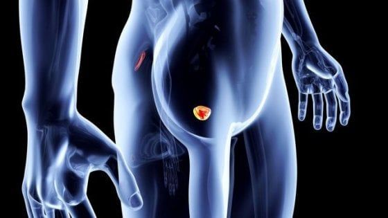 Tumore prostata, un nuovo test potrebbe sostituire il Psa