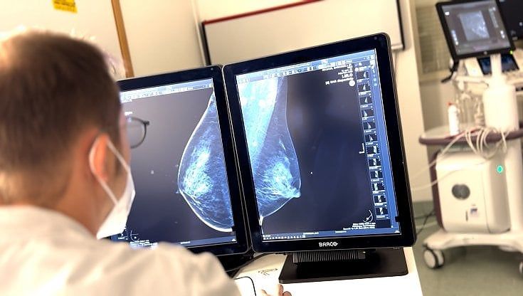 Al Policlinico di Bari l'intelligenza artificiale aiuta nella diagnosi dei tumori al seno. Moschetta: "Il software accorcia i tempi"
