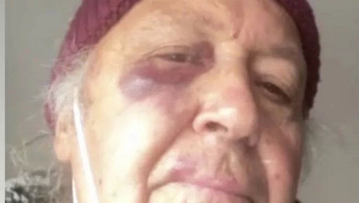 Elio Cipri, il padre di Syria preso a pugni per un rimprovero sulla mascherina: "Nonostante tutto lo rifarei"